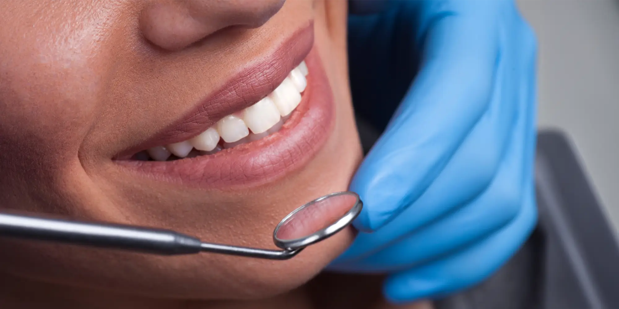 Dental Greeley CO Smiling Woman